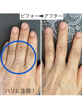 桃の木 吉祥寺店/ハンドケアで潤う手 2