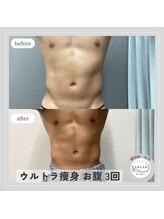 カラー(CALLA)/筋肉カット出し♪