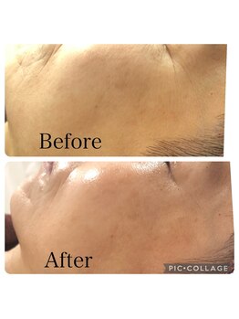 プラム(PLUM)/陶肌トリートメント