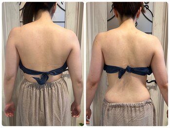 ブリリアント(Brilliant)/花嫁さん絞込みエステ