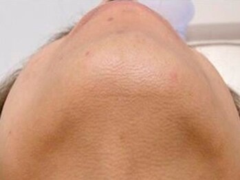 ネイルスペース 結の写真/男性も脱毛する時代！最新光脱毛で清潔感のあるモテ肌で好印象に♪ほぼ痛みなし＆肌ダメージ最小限◎