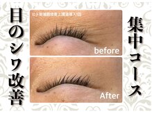 レガロビューティ 麻布十番(REGALO Beauty)の雰囲気（気になる目シワ改善集中コースもたくさんの方から喜ばれています）