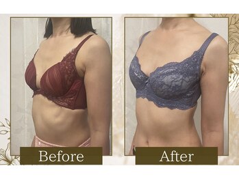 マリン(MARINE)/全身整うバストケア♪ビフォアフ