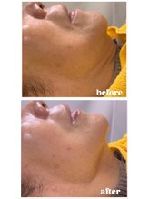 アンパス(Unpas)/一度の結果に自身あり！