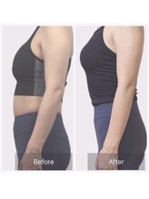 アンドゥ(undo)/美姿勢美脚コース