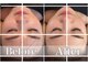 モッチ 天神大名店(MOCCHI)の写真