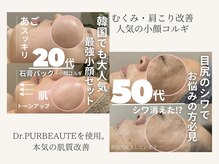 リノ(Lino)/BeforeAfter