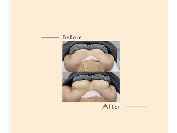 オベリオ(OBERIO)/