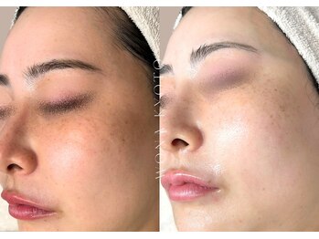 ウォナ(WONA)/【お客様症例】