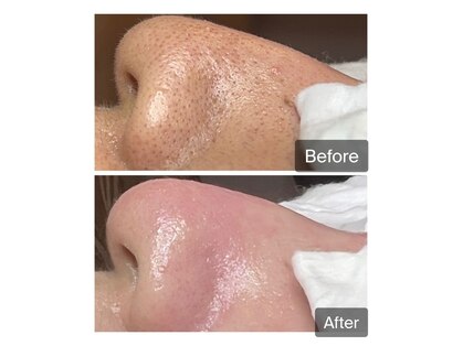 癒える(ielu)の写真