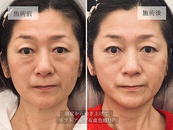 ル キヤ アイスペシャリテ ハービスENT店/ビフォーアフター◆目元&ヘッド