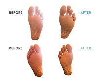 リブリース(RE:Bliss)/足つぼ後の変化