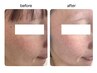 【乾燥・ハリ不足に】肌を育てる毛穴洗浄60分￥4800→3800