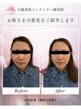 小顔美肌ファクトリー 梅田院/