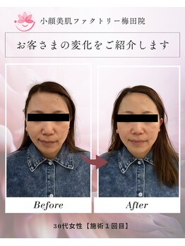 小顔美肌ファクトリー 梅田院/