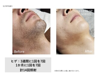 ケーナイン(K-9)/毎朝の髭剃り時間を短縮◎