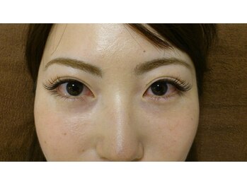 ルビジュー(le bijou)/100本