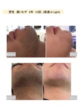 チェリーブロッサム 上福岡店(CHERRY BLOSSOM)/