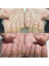 アンディ(Andy)/クリアネイル