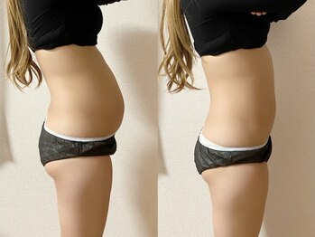 アイラッシュ ラピス(Lapis)/マグブレイク／ぽっこりお腹撃退