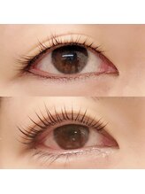 スタジオ エフ(Studio-F)/ダブルアイリフト