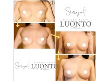ルオント(LUONTO)/施術×栄養×セルフケア×光豊胸
