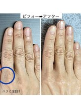 桃の木 吉祥寺店/ハンドケアで潤う手　1