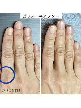 桃の木 吉祥寺店/ハンドケアで潤う手 1