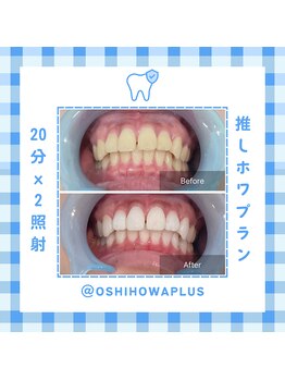ベルプラス 新大阪(Belle plus)/Belle plus ホワイトニング