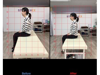ストレチックス 近江八幡店/BeforeAfter
