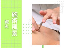 よし鍼灸接骨院 東花園院/鍼灸