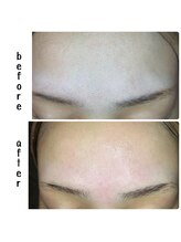 ラフィーユ うるま店(Lafille)/フェイシャルWax直後にツルスベ