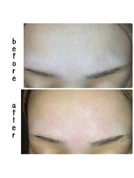 ラフィーユ うるま店(Lafille)/フェイシャルWax直後にツルスベ