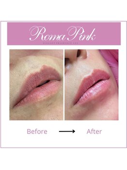 スターティス(STATICE)/ローマピンク 唇 1回