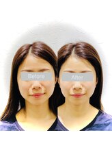 ワカヤマ 小顔(Wakayama)/★Before・After★