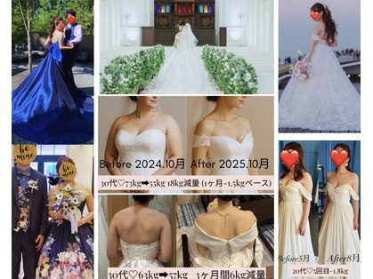 ビルーチェ(美LUCE)の写真