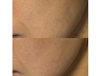 ベルアイラッシュ(Belleyelash)/【フェイシャルワックス】