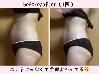 ヨサパーク ベアトリーチェ(YOSA PARK beatrice)/極上プレミアムコース一回