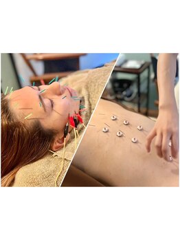 鍼灸施術を受けたい