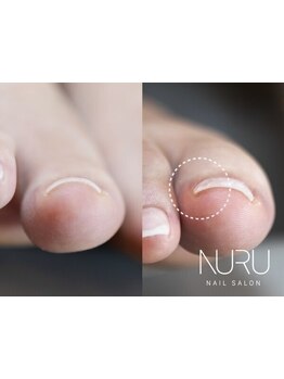 爪の悩みを解消できる（ケア含む）