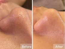 メナードフェイシャルサロン フェアリーナナ