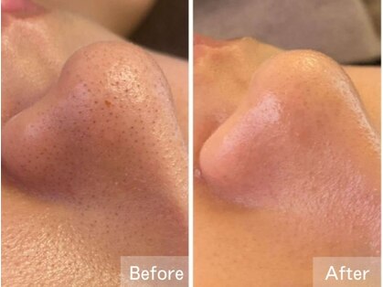 メナードフェイシャルサロン フェアリーナナの写真