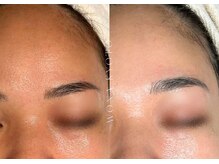 ウォナ(WONA)/【お客様症例】