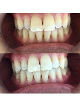 ミラ 中央林間(mira)/小顔　毛穴　ホワイトニング