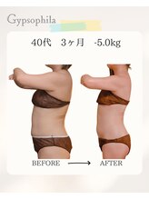 ジプソフィラ(Gypsophila)/リバウンドをしない痩身エステ