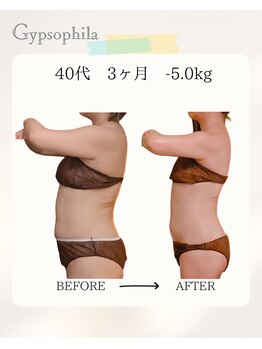 ジプソフィラ(Gypsophila)/リバウンドをしない痩身エステ