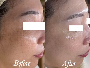 ローズルート(Rose route)/30代後半会社員さん　9回施術