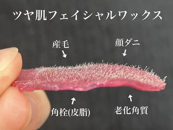ピース(PEACE)の写真/艶肌フェイシャルワックス+水分補給パックでつるつる素肌に！毛穴汚れや詰まりもスッキリと★化粧ノリも◎