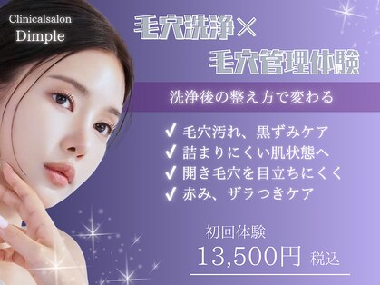 ディンプル(Dimple)の写真