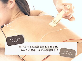 シーズ ラボ 吉祥寺店/意外と知らない背中ニキビの原因